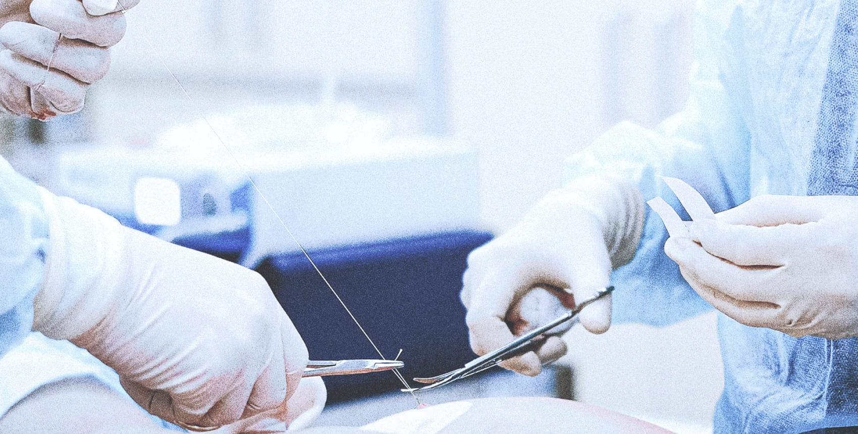 海外の常識を、日本の現場にディスポーザブル製品導入の挑戦と苦闘